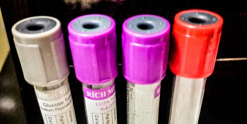 Laboratory sample test tubes